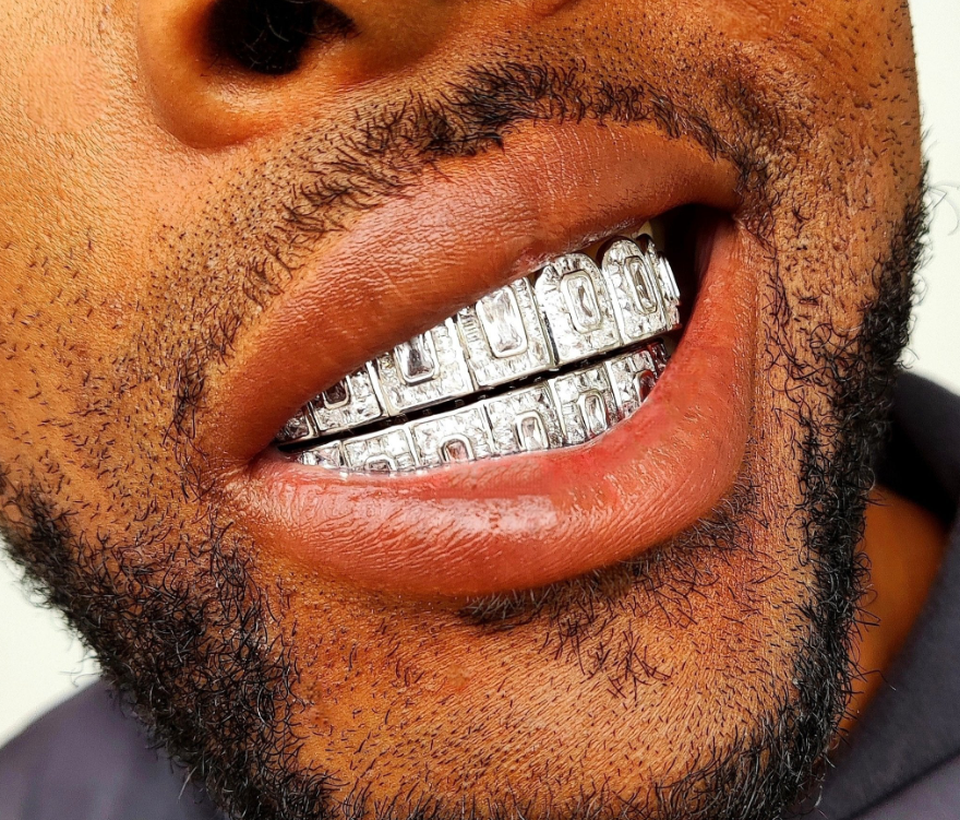 White Gold Grillz